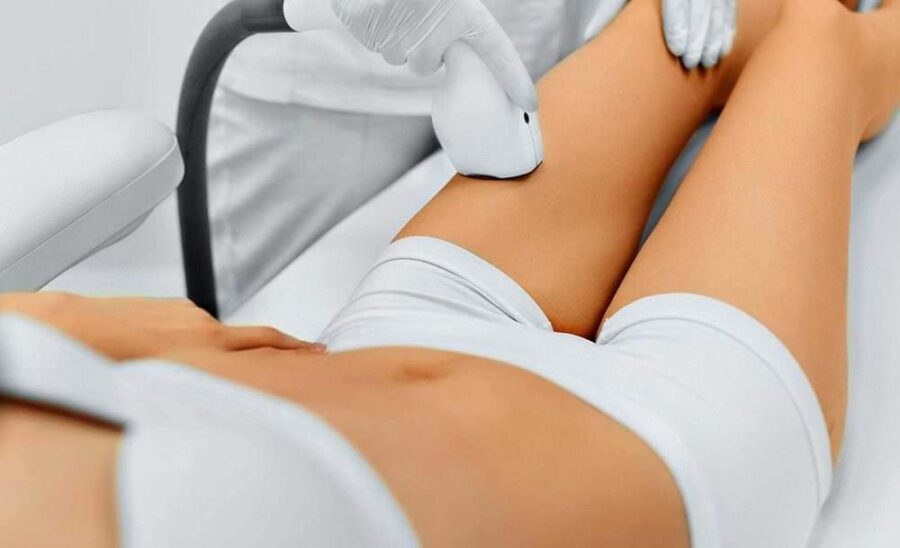 Dauerhafte Haarentfernung mit Dioden Laser Behandlung